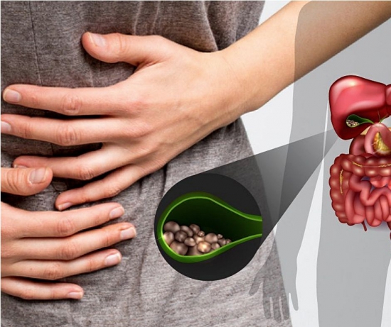 TRIỆU CHỨNG VÀ NGUYÊN NHÂN GÂY SỎI MẬT